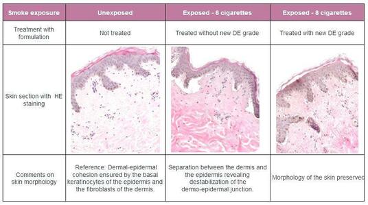 Exposure of skin explants to cigarette smoke