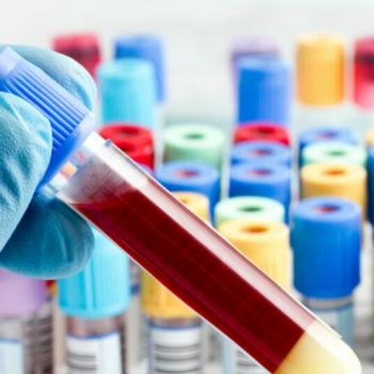 Celpure® USP-NF grade filter media is used to reduce endotoxin content in a microbial lysate in a lentiviral plasmid recovery process